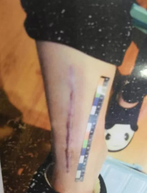 麻小薯世界 “被未成年用水瓶塞下体后,我的全裸受虐视频在朋友圈疯传”