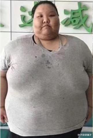 |近400斤女孩把床压塌，胖到只能睡地板，减肥1年后父母差点没认出来