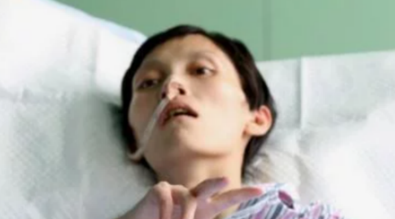 胃癌|26岁女子不近烟酒,确诊胃癌,医生叹息:怎能把1种“素食”当饭吃