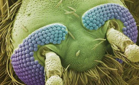 显微镜 电子显微镜下的围观世界, 让人称奇