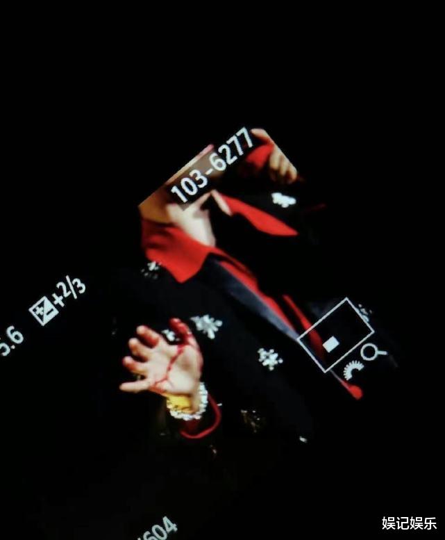 张杰|张杰演唱会出舞台事故，仰面从升降机摔下手流血，现场曝光