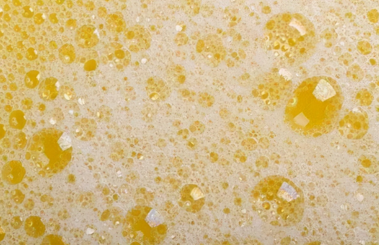 肝脏|男孩每天吃“1鸡蛋”，肝癌离世，马上停食这“2物”，小心肝脏烂如渔网