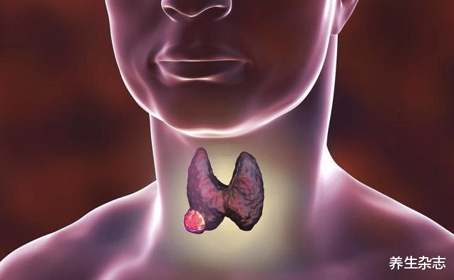 高血脂|甲状腺不会无缘无故“罢工”,若出现3种症状,结节正“藏”在体内