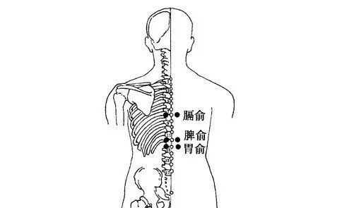脑卒中|针灸穴位治疗各类痛证