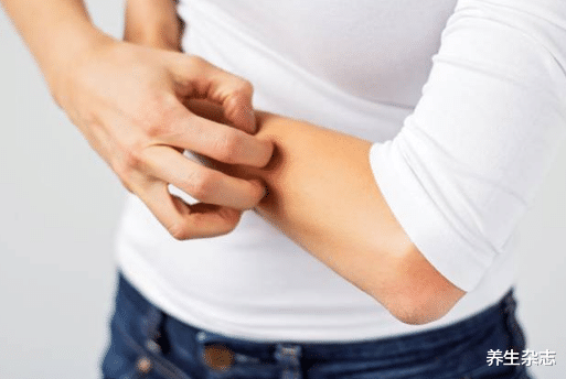 肝癌|肝癌发现即晚期?肝科主任,身体出现“1痒、1疼”,早做肝CT