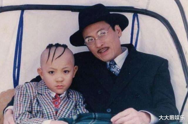 孟智超|“三毛”孟智超，8岁成名，14岁秃顶，植发挨300多针，现在变身帅哥