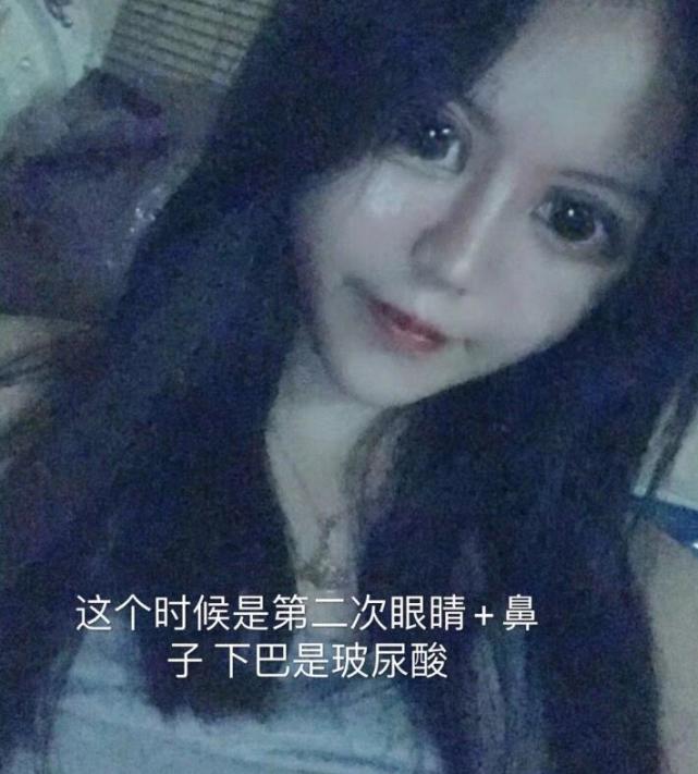 张卫健|15岁女网红花费400万整容成瘾，天天晒照自认为很美，网友吐槽像60岁