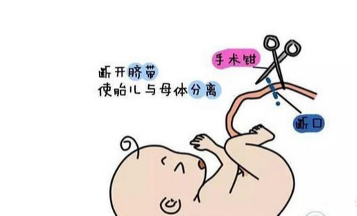 王晗说聊育儿|胎儿刚出生就哭了，是因为剪脐带很疼吗？