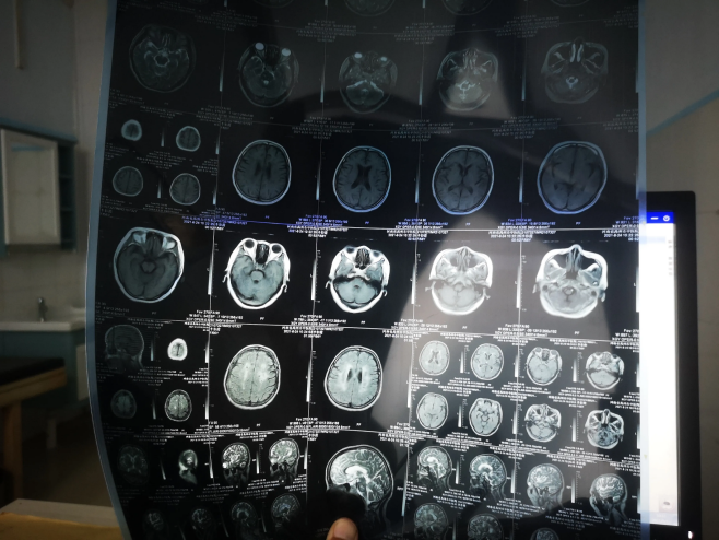 天天听健康|血管“强化剂”被揪出,西红柿未上榜,榜首天天吃,血管一通到底