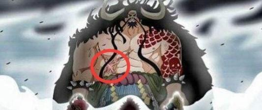 凯多|海贼王：接近无敌的凯多腹部伤疤，这个疤痕是怎么来的呢？