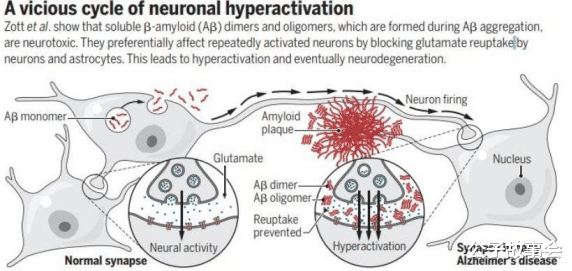 阿尔茨海默病|伟哥凭啥进医保？这不仅事关男性的“幸福”