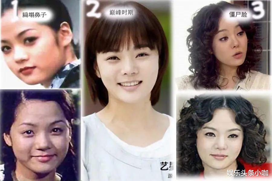 整容|盘点那些整容失败的韩国明星，你们还会有整容的想法吗？