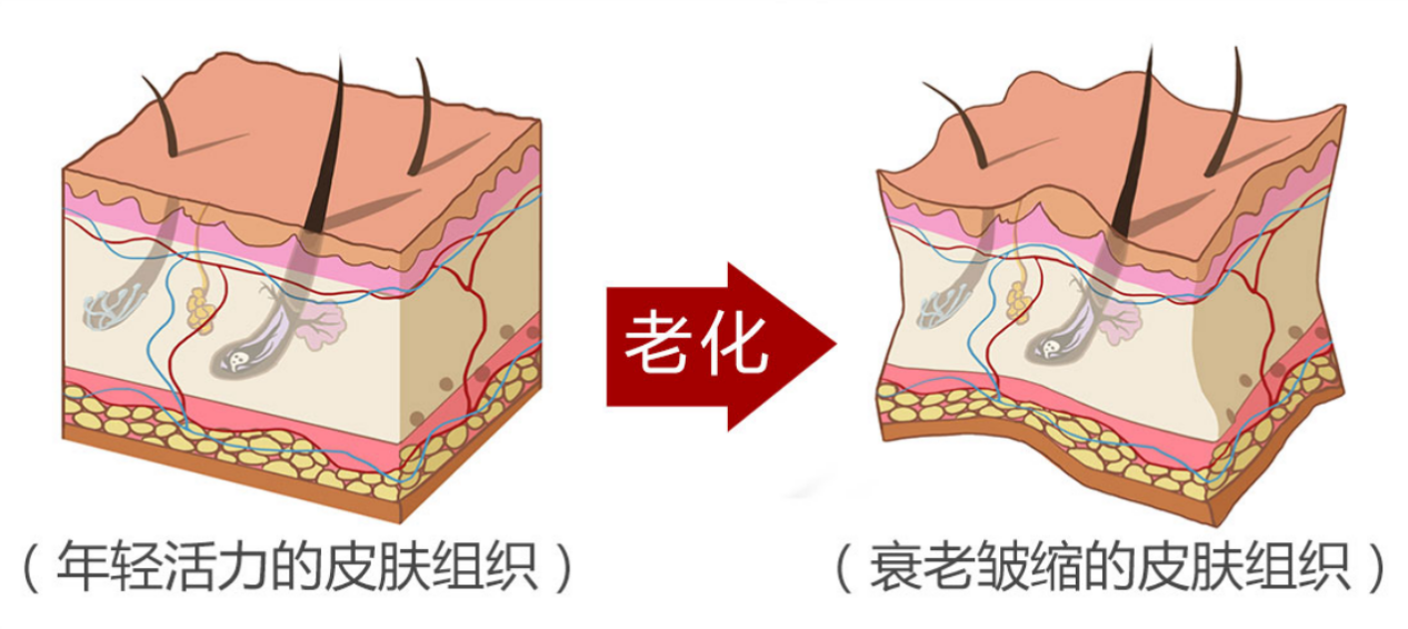 疾病|怎么样看起来年轻?——王小民教授帮您解答