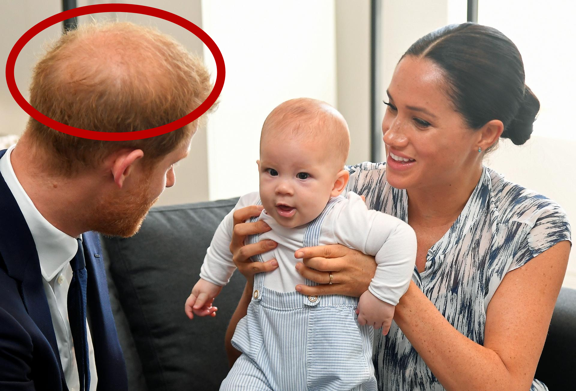 為什麼威廉王子已經禿頂而哈裡王子卻還擁有一頭濃密的頭發呢？-圖4