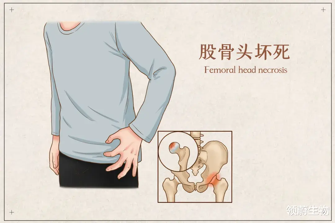 领蔚生物|研究丨干细胞调节股骨头坏死前景不可估量