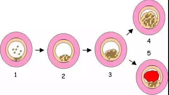 疾病|身体各器官的求救信号，知道了能救命！50岁后一定记住！