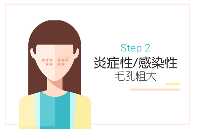 短发 美白淡斑哪个牌子好用 补水淡斑精华液排行榜