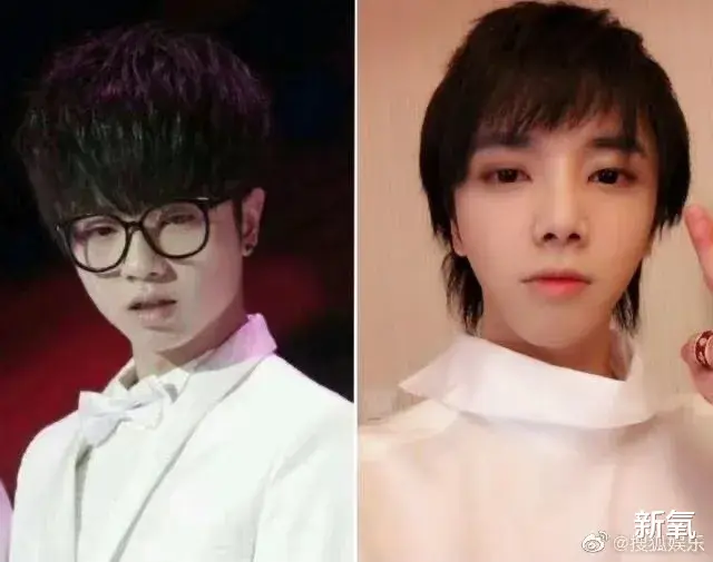 华晨宇|从头皮换到脸皮，华晨宇做过的项目比他的作品还多吧？