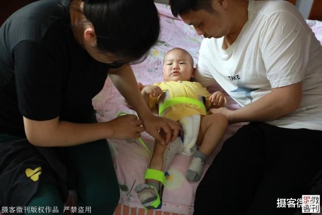 摄客微刊 1岁双胞胎哥哥患上罕见病，妈妈抱弟弟也去检查，结果崩溃了