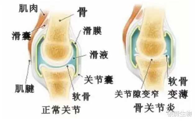 骨关节炎|你的膝盖还好吗?干细胞或将成为膝骨关节炎最有效的调节方式!