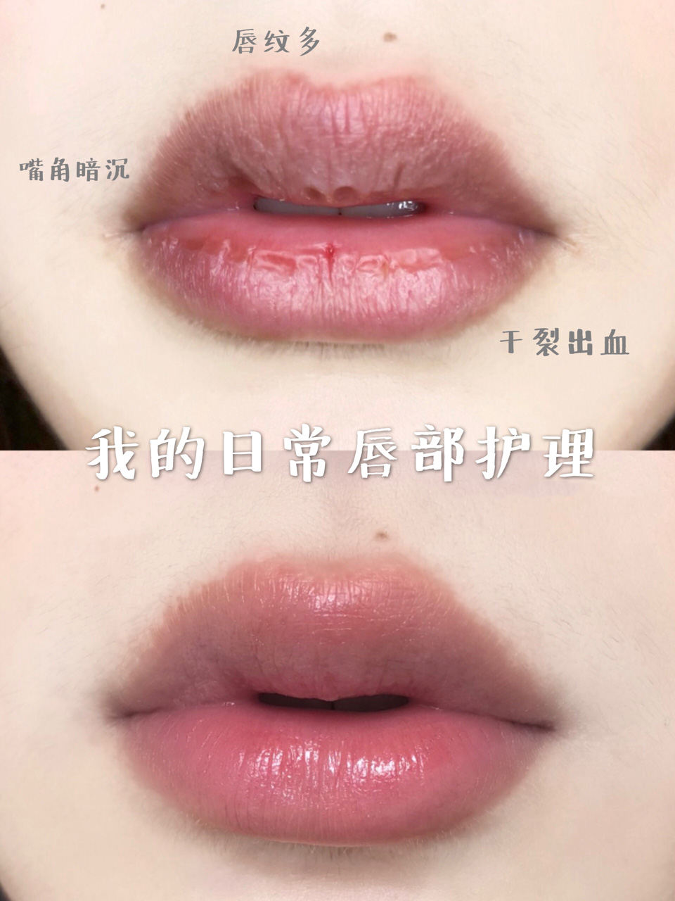 唇膏 小蓝罐有“毒”？雅顿过敏得唇炎？孕期唇膏哪家强？宝妈带你排雷