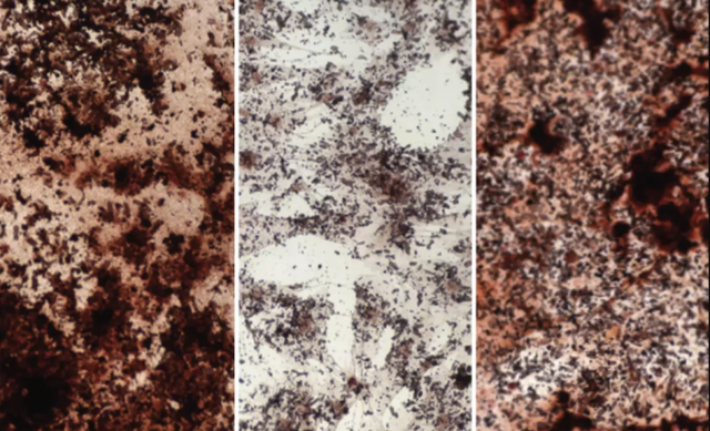 科学家 科学家利用添加醋酸钠提高骨骼干细胞的活性