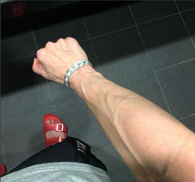 医生|有些人手臂上“青筋暴起”，有些人却看不到，为什么？听医生科普