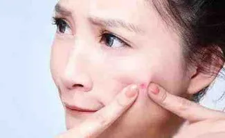 小芙说健康|脸上不同部位长痘的原因是什么？如何改善脸上长痘的情况