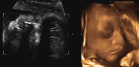翟文利说育儿|你们觉得产检最难过的项目是哪些？