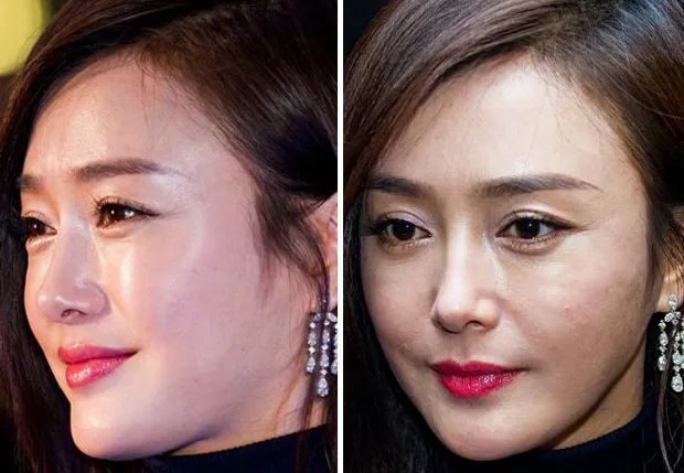 小贝|秦岚：为2个男人付出了一切，黄晓明让她赔得最惨