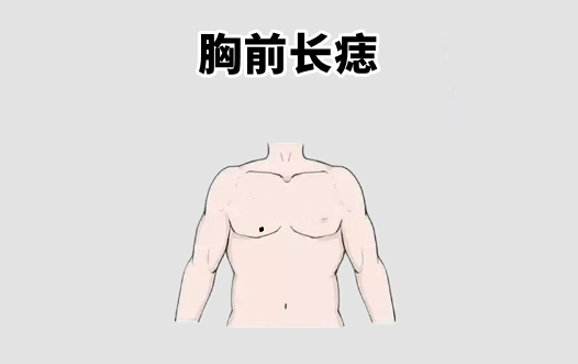 中国易经风水 “百里难挑的5颗痣”，个个不差钱，前半生富，后半生福！
