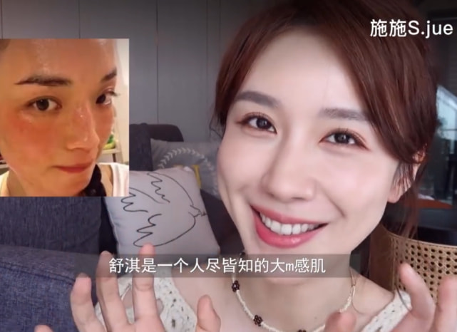 医生|王菲御用医生透露女星们常做医美项目：范冰冰常做镭射净肤，刘涛常打水光针