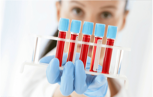 卵巢|肌酐260如何阻止肾衰？肾内医生给出4条中肯建议，全做到风险低