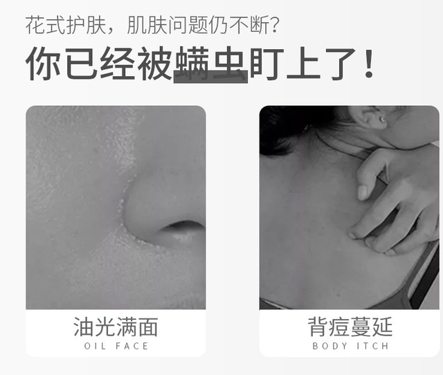好物官|建议女生：若脸上这3个感受明显，那你就是“螨虫脸”，趁早改善