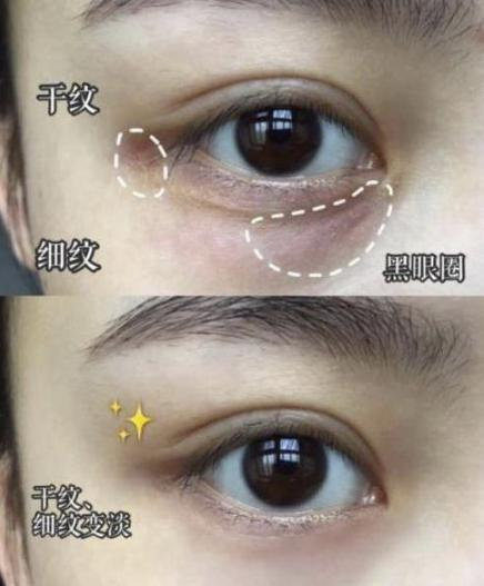 眼霜|“涂眼霜”的4种错误方法，就算是千元眼霜也是浪费钱还没效果