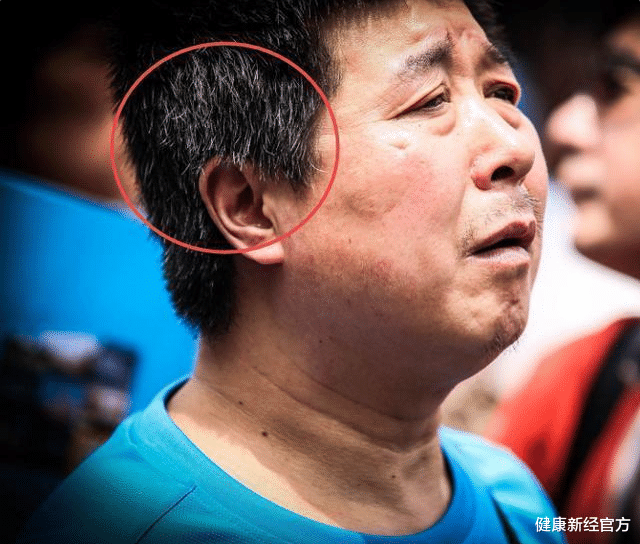 肝脏|男性晨起上厕所有3个异常，肝或已悄悄变“硬”，一个不占，肝还算“轻松”