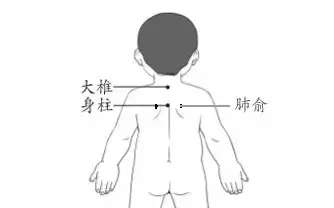 香艾儿|三伏灸之儿童篇 | 增强体质、少生病！