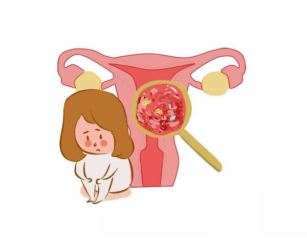 健康周谈 早期宫颈癌3个信号不难发现，女性哪怕占一个，也要去检查一下