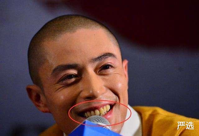 严选|我国“最低调国宝”牙膏，因太便宜被无视，网友：用后牙黄牙渍消失了