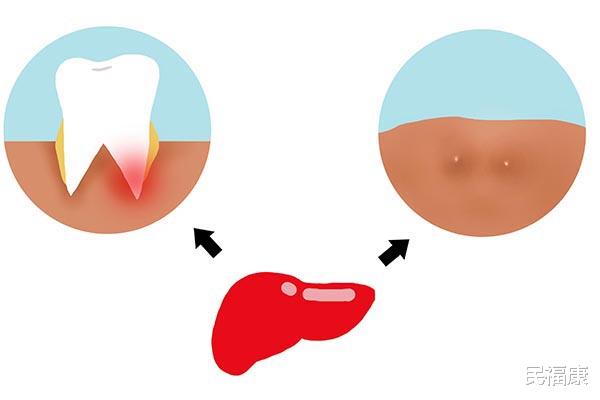 乙肝|家中有乙肝患者，该怎么办？为家庭成员的健康，做好几点很重要