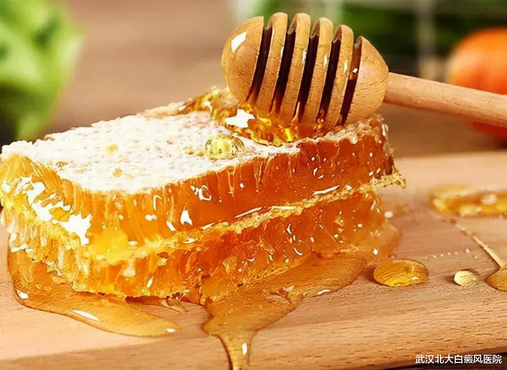 肾病|听说喝蜂蜜水3个月就能治好白癜风,是真的吗?