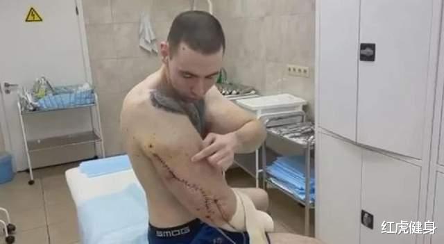 俄罗斯|“俄罗斯大力水手”，61厘米手臂面临手术，否则将有截肢风险