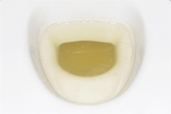 肝脏|俗话“肝火一烧,百病难熬”,肝火旺常见6个表现,你中招了吗?