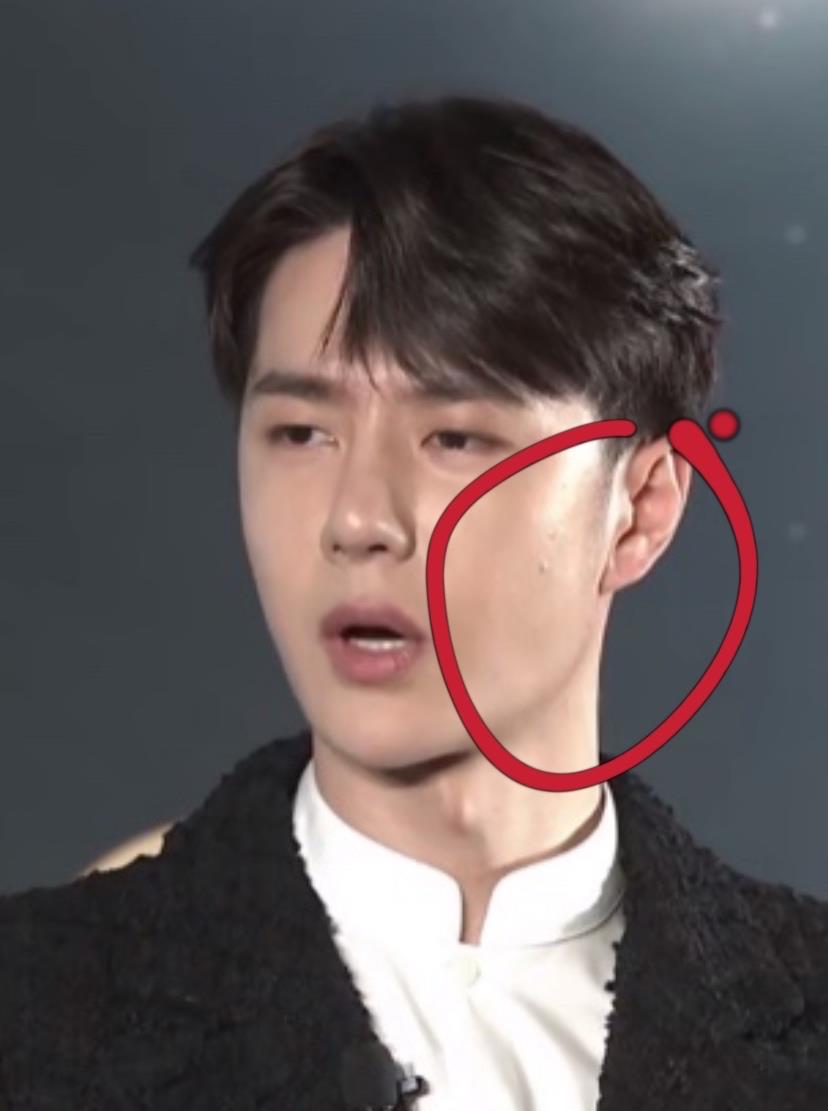 王一博|《风起洛阳》发布会宋轶缺席！王一博脸上“起痘”，身体疑似不适