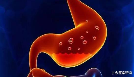 古今医案研读|肠胃“保护伞”已发现,不是大蒜,若爱吃,除菌养胃,强壮胃功!