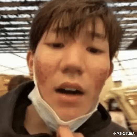 明星素颜|15位当红男星素颜：眯眯眼、月球表面、满脸痘，还暴露动脸痕迹