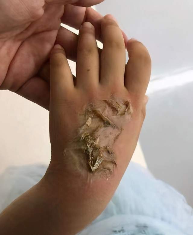设计师|电话手表自燃烧伤女童，家长们快看看有没有买过这款智能手表？