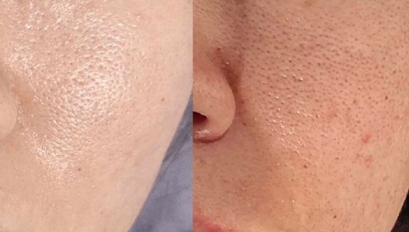 肝脏|肝脏“救命恩人”发现了,家中常备,转氨酶稳定于30间,面色红润精神好