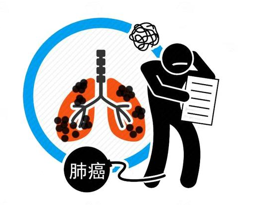 医生胡侃|肺病早期有征兆！身体有“1大1痛2黑”，别不在意，或是肺癌预警