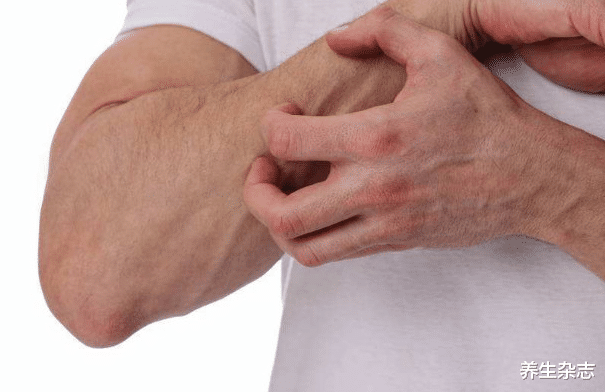 肝脏|身体2处“瘙痒”，八成是肝病，提醒：2种美食趁早忌口，忍住就是赢